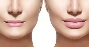Chăm sóc da hỗn hợp